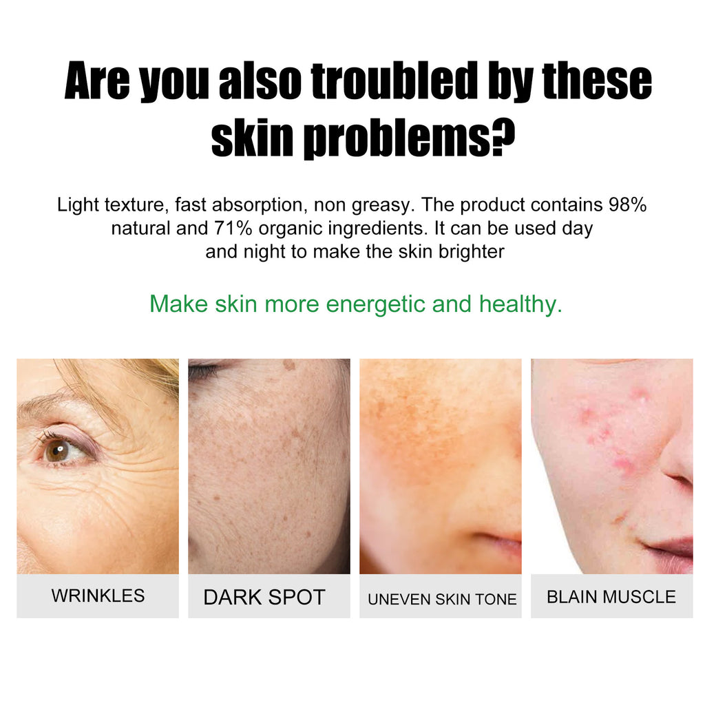 Anti-Acne and Blemishes Skin Care Cream – Brightening, Moisturizing & Anti-Acne Daily Care - Icon Her