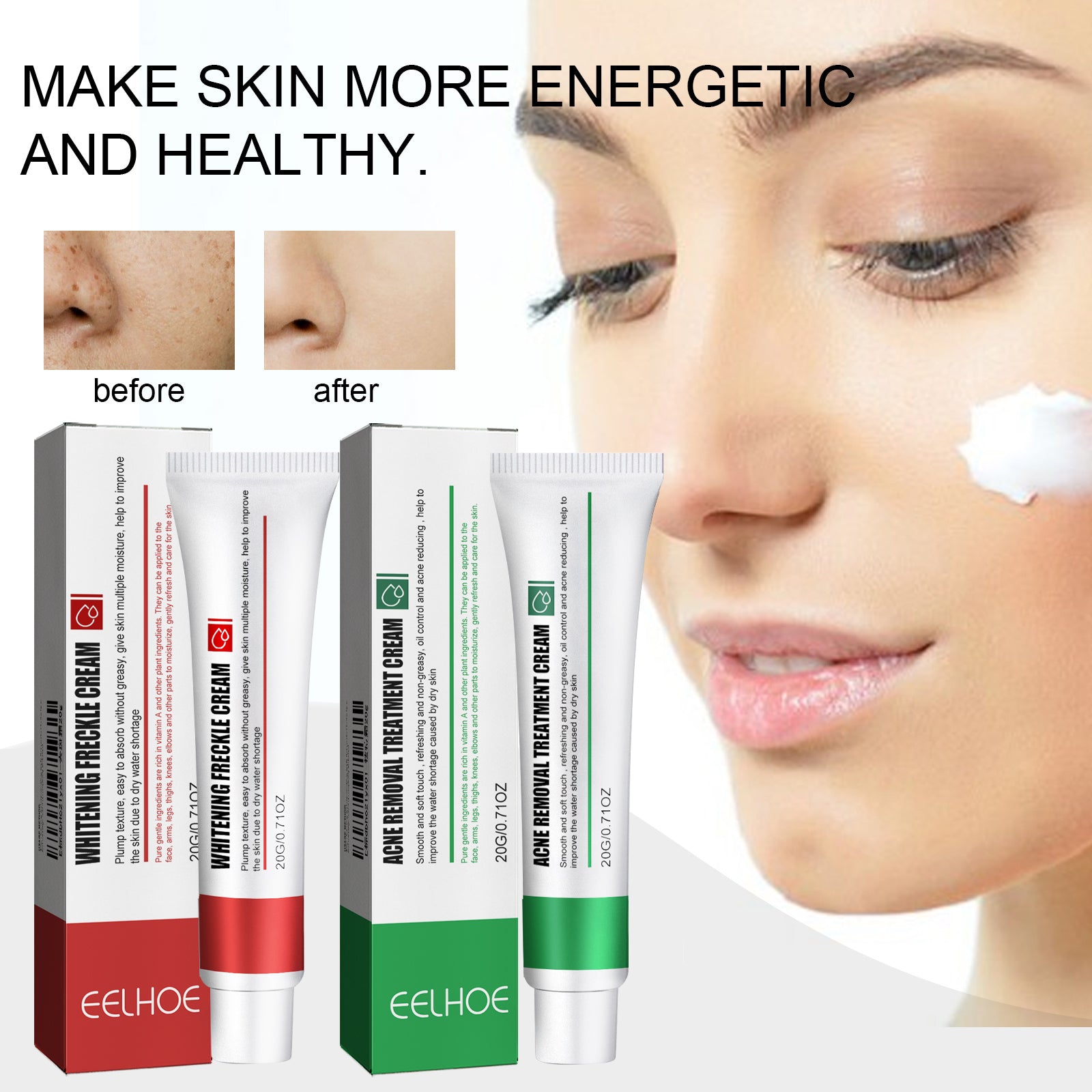 Anti-Acne and Blemishes Skin Care Cream – Brightening, Moisturizing & Anti-Acne Daily Care - Icon Her