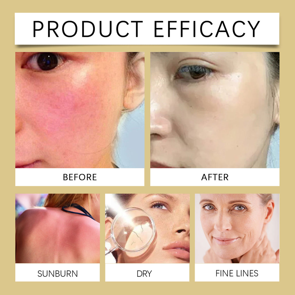 Sunscreen Mist – Hydrating, Moisturizing & Skin Repair SPF Spray - Icon Her