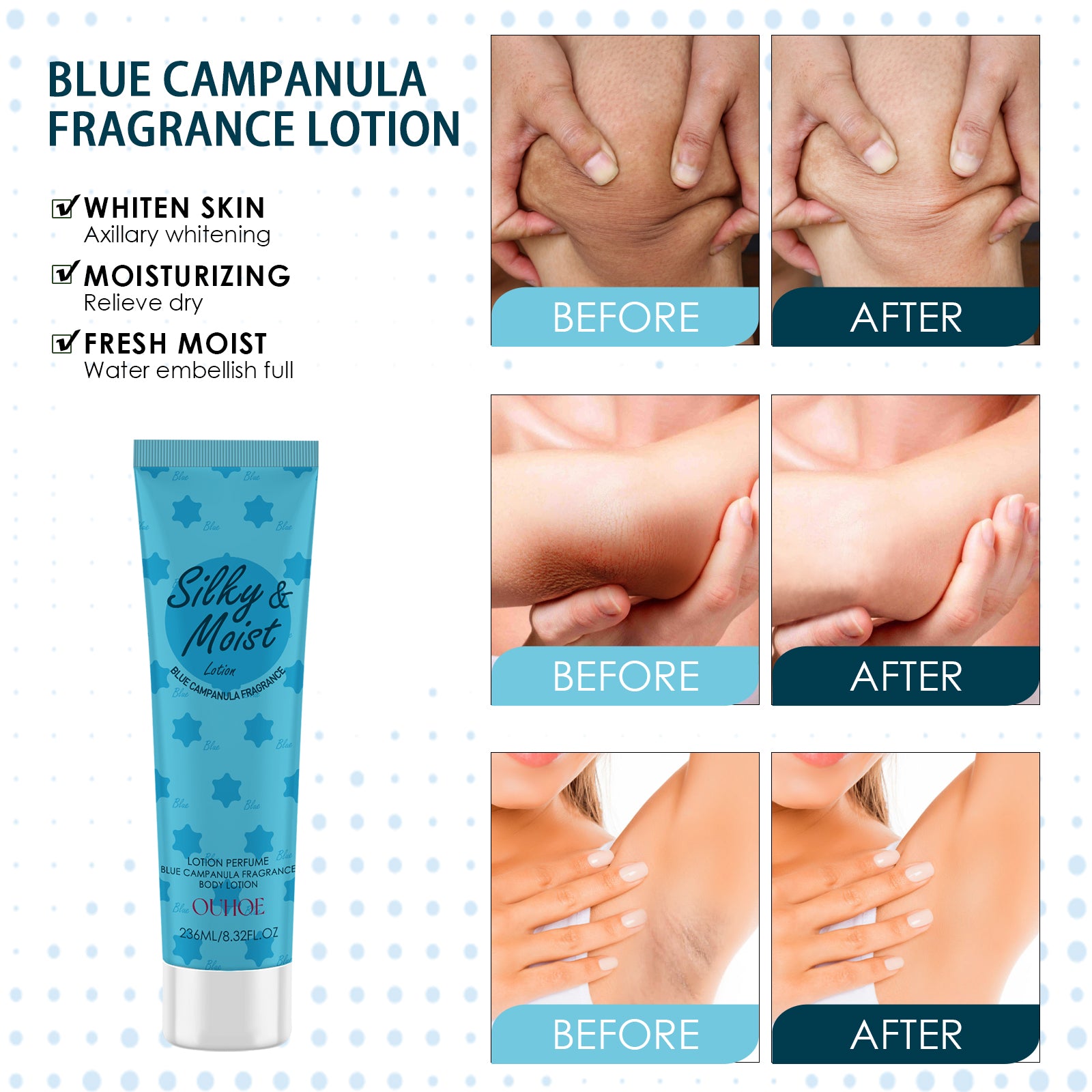 Brightening Body Lotion – Lightening Underarm, Knee & Dark Spots Moisturizing Care - Icon Her