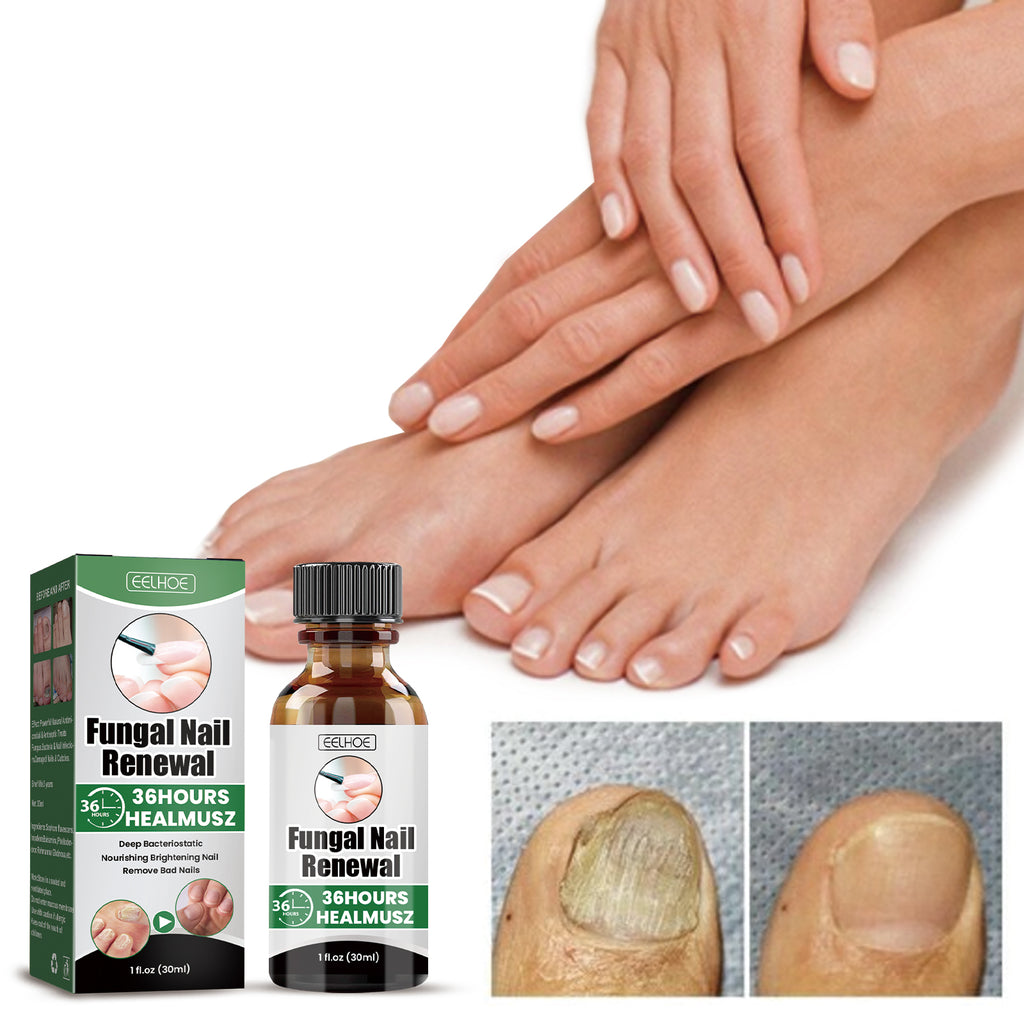 Nail Repair Lotion – Brightening, Nourishing & Moisturizing Nail Care - Icon Her