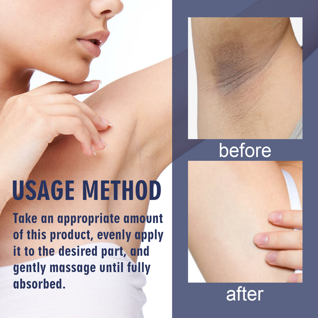 Underarm Care Cream – Lightening Knee, Elbow & Dark Spot Moisturizing - Icon Her