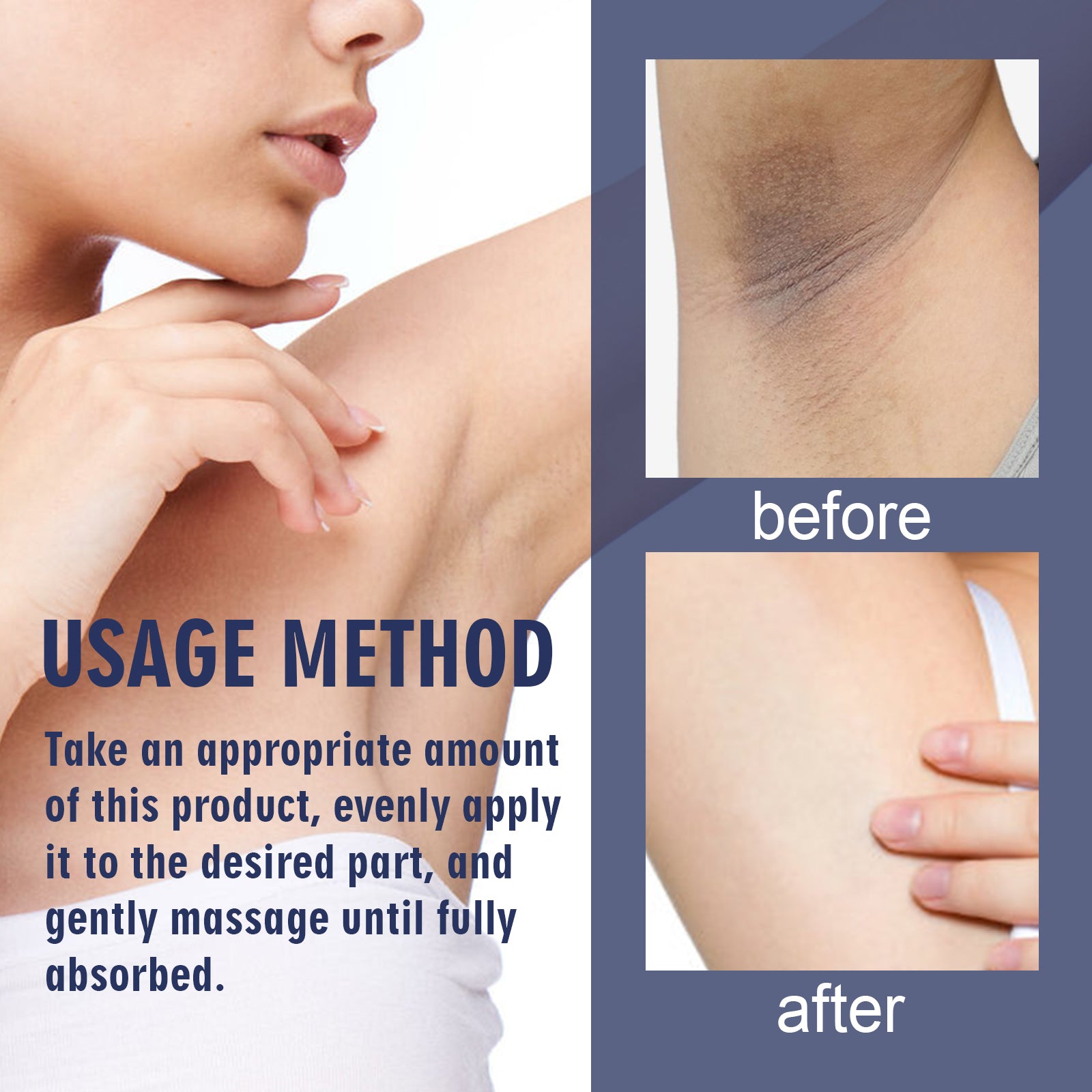 Underarm Care Cream – Lightening Knee, Elbow & Dark Spot Moisturizing - Icon Her
