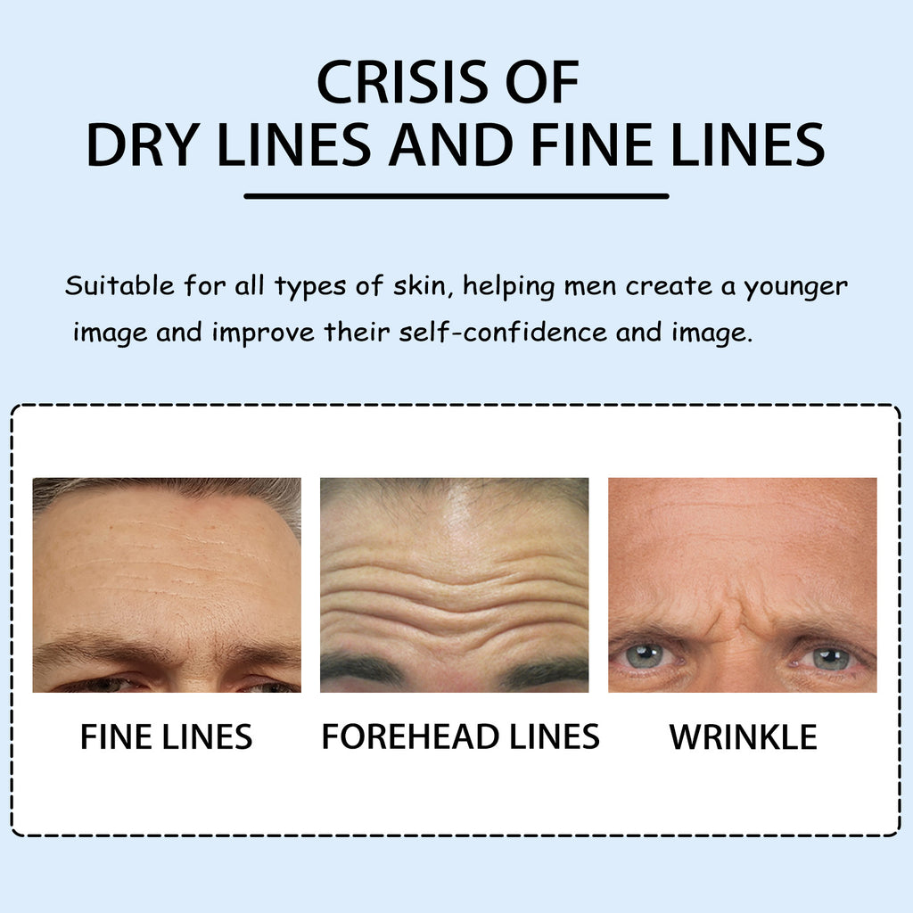 Men's Forehead Wrinkle Patch – Firming & Fine Lines Reducer - Icon Her