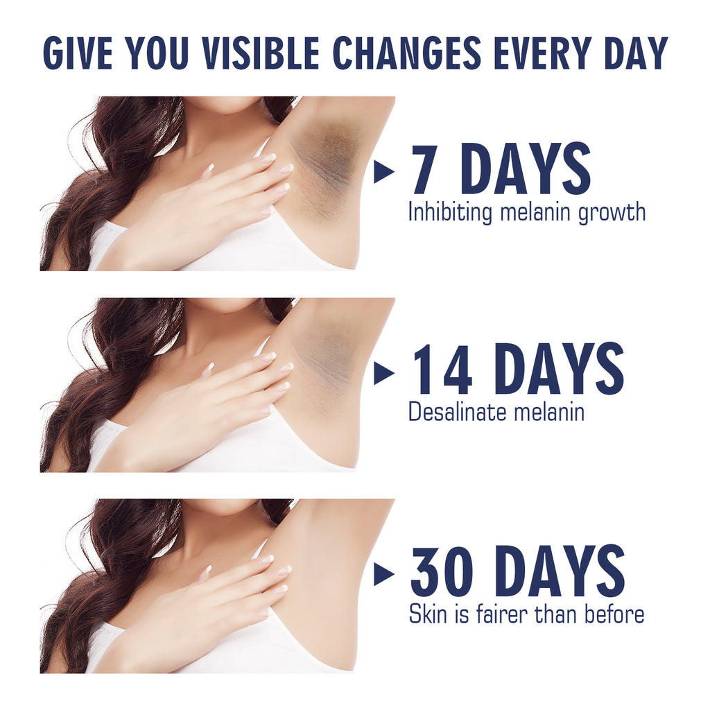 Underarm Care Cream – Lightening Knee, Elbow & Dark Spot Moisturizing - Icon Her