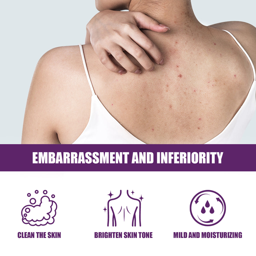 Lavender Body Exfoliating Gel – Deep Cleansing, Anti-Acne & Brightening - Icon Her