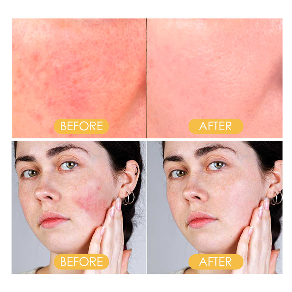Setting Powder – Lightweight, Oil Control, Waterproof & Long-Lasting Makeup - Icon Her
