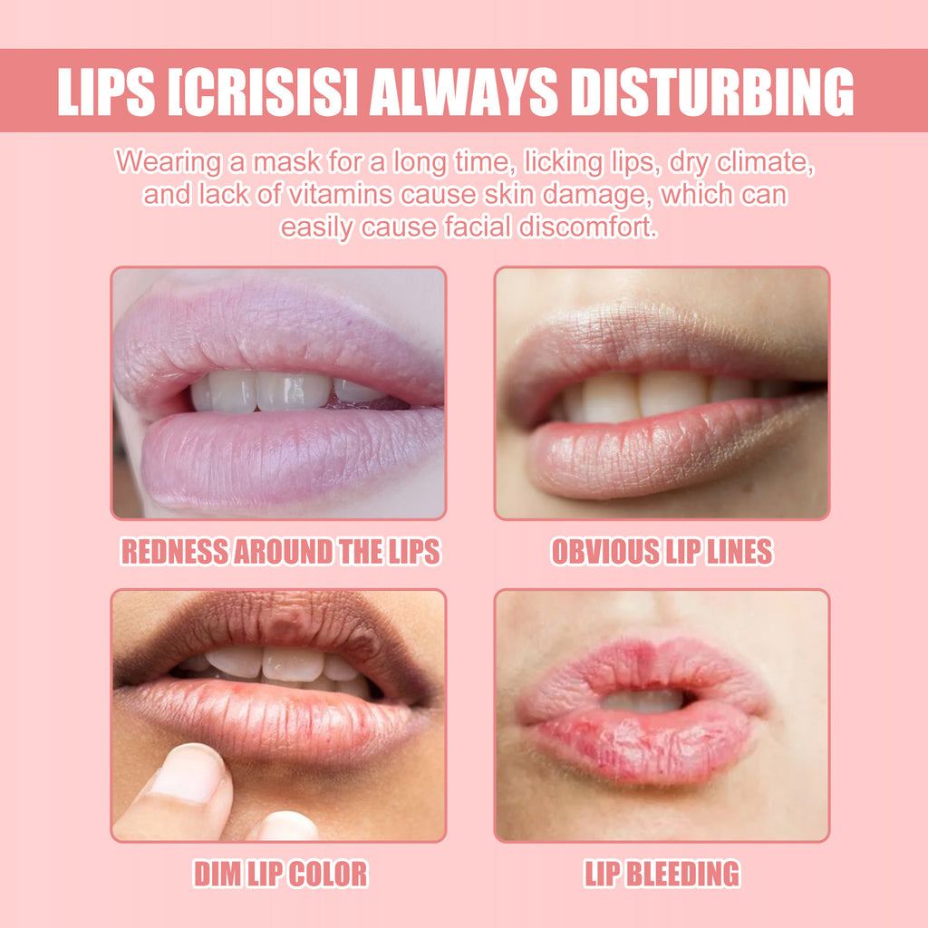 Strawberry Hydrating Lip Mask - Line-Smoothing & Exfoliating Lip Treatment - Icon Her