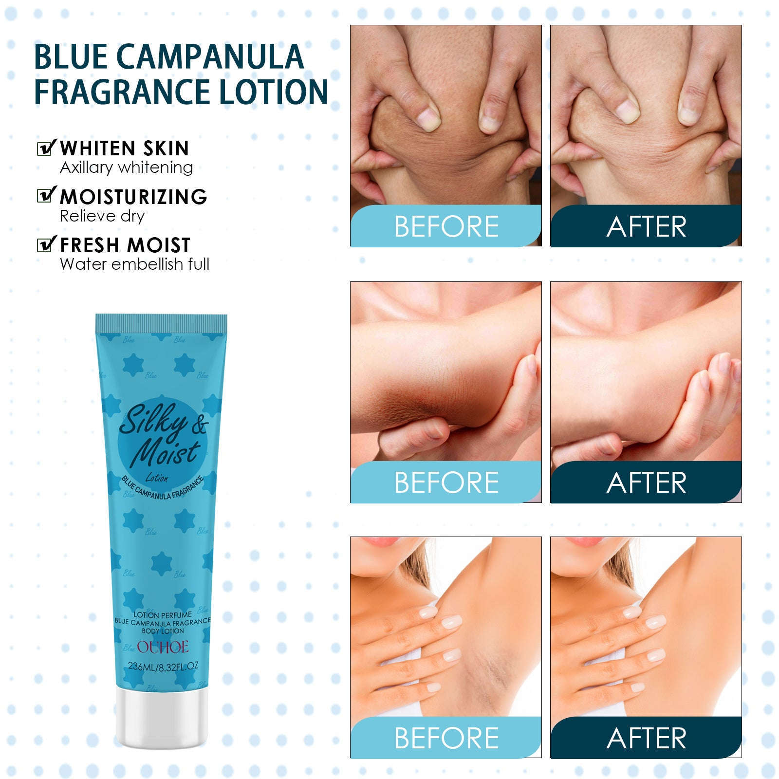 Brightening Body Lotion – Lightening Underarm, Knee & Dark Spots Moisturizing Care - Icon Her
