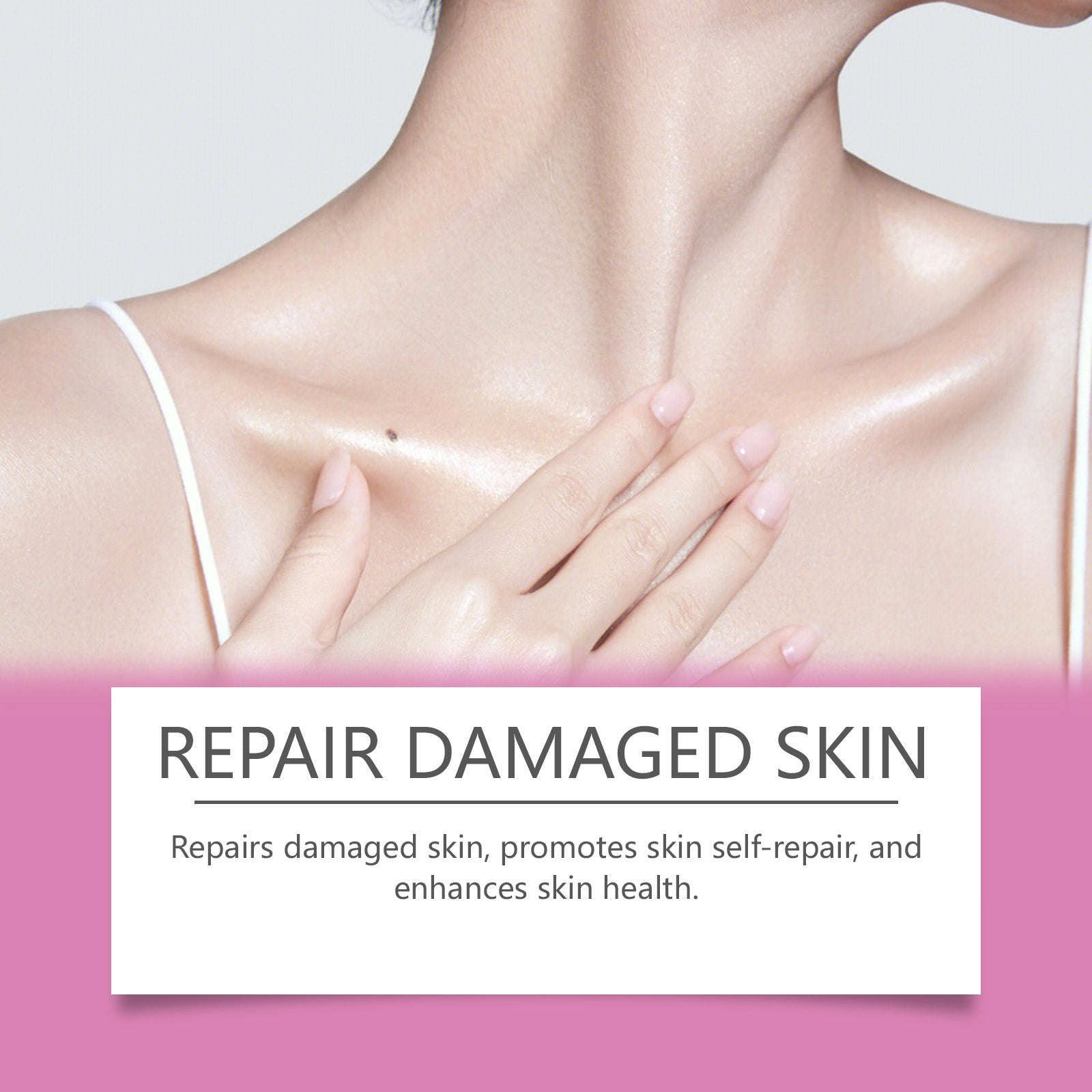 Extra Strong Peeling Oil - Brightening, Anti-Stretch Marks, Scars And Dark Spots - Icon Her