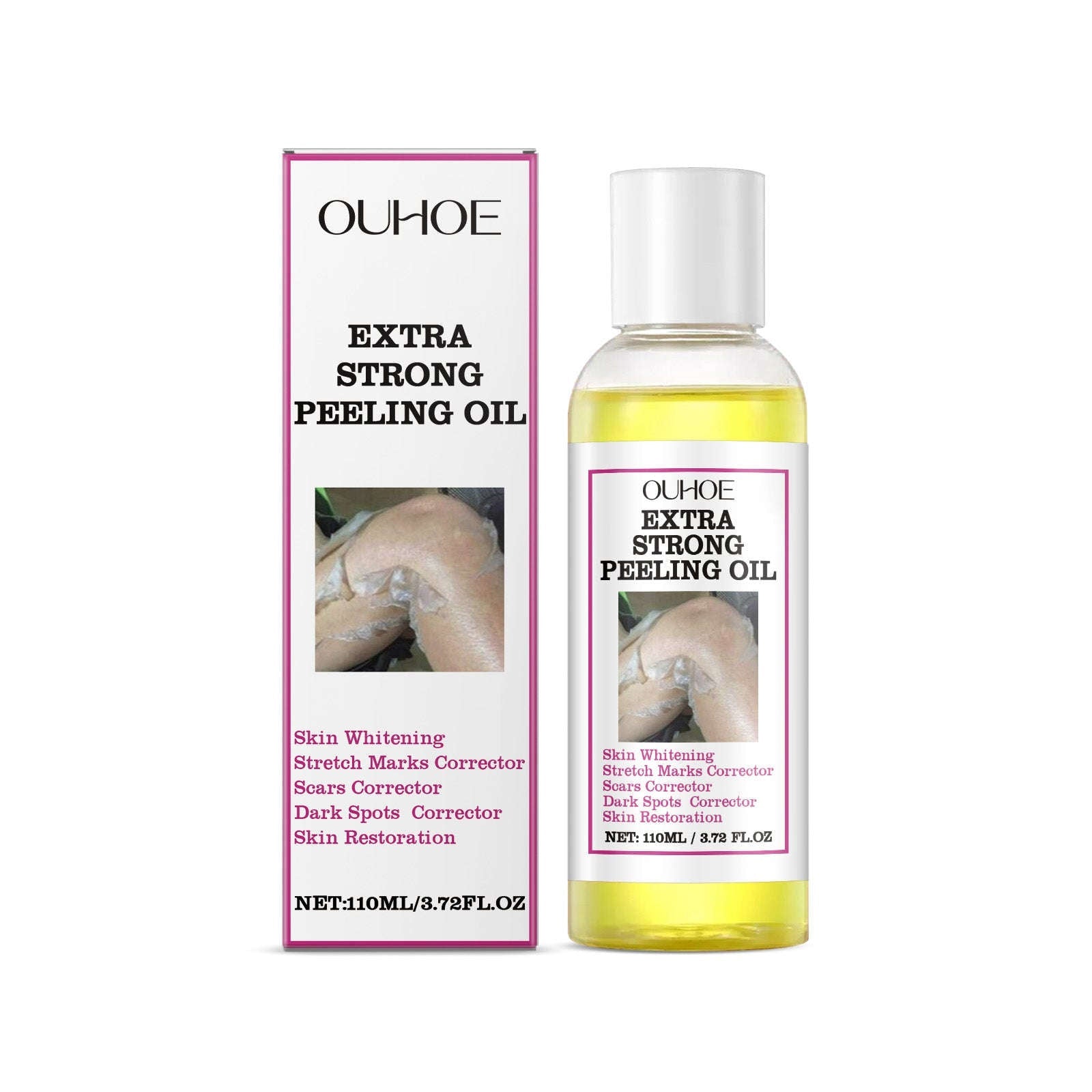 Extra Strong Peeling Oil - Brightening, Anti-Stretch Marks, Scars And Dark Spots - Icon Her