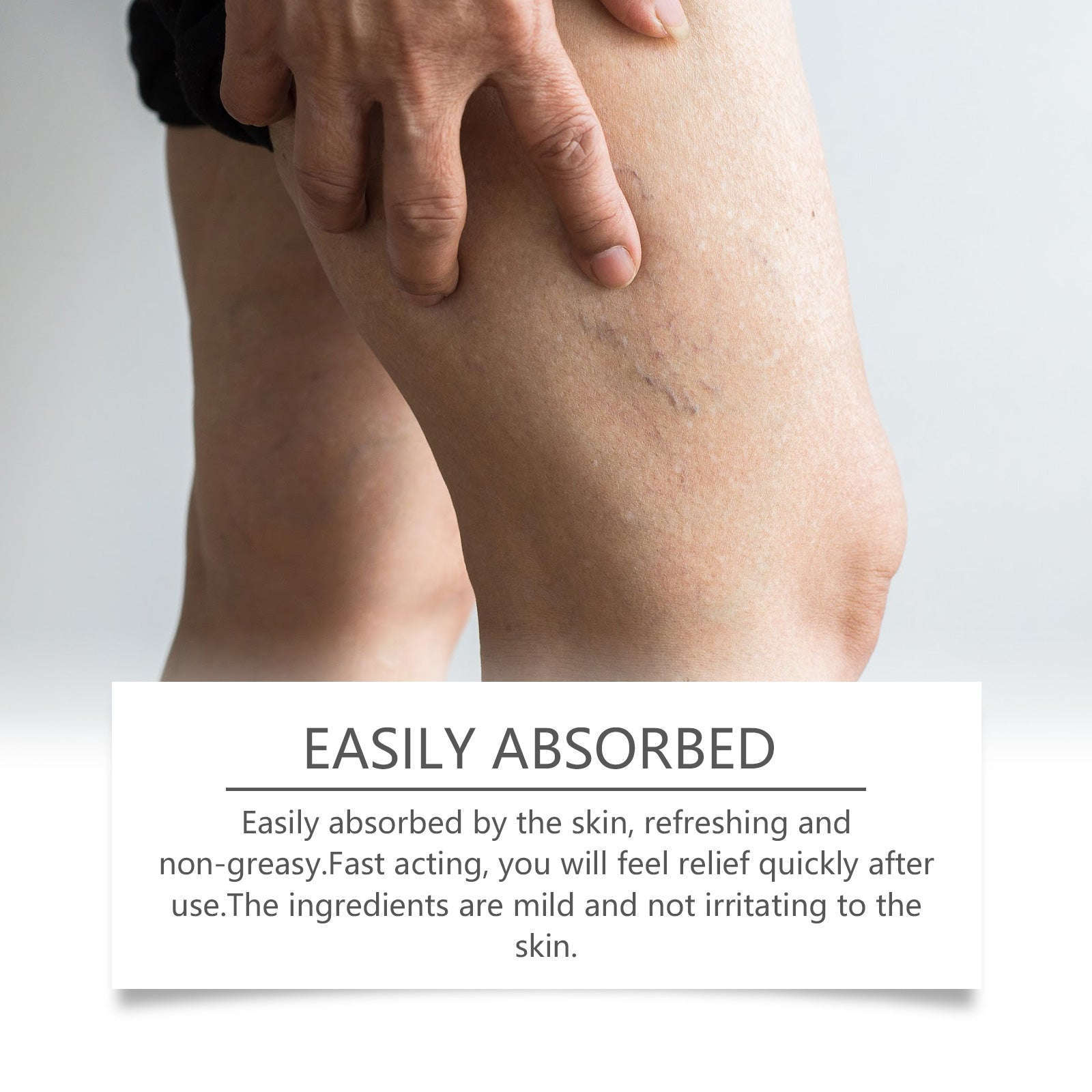 Leg Care Cream – Gentle Relief, Daily Massage & Topical Treatment - Icon Her