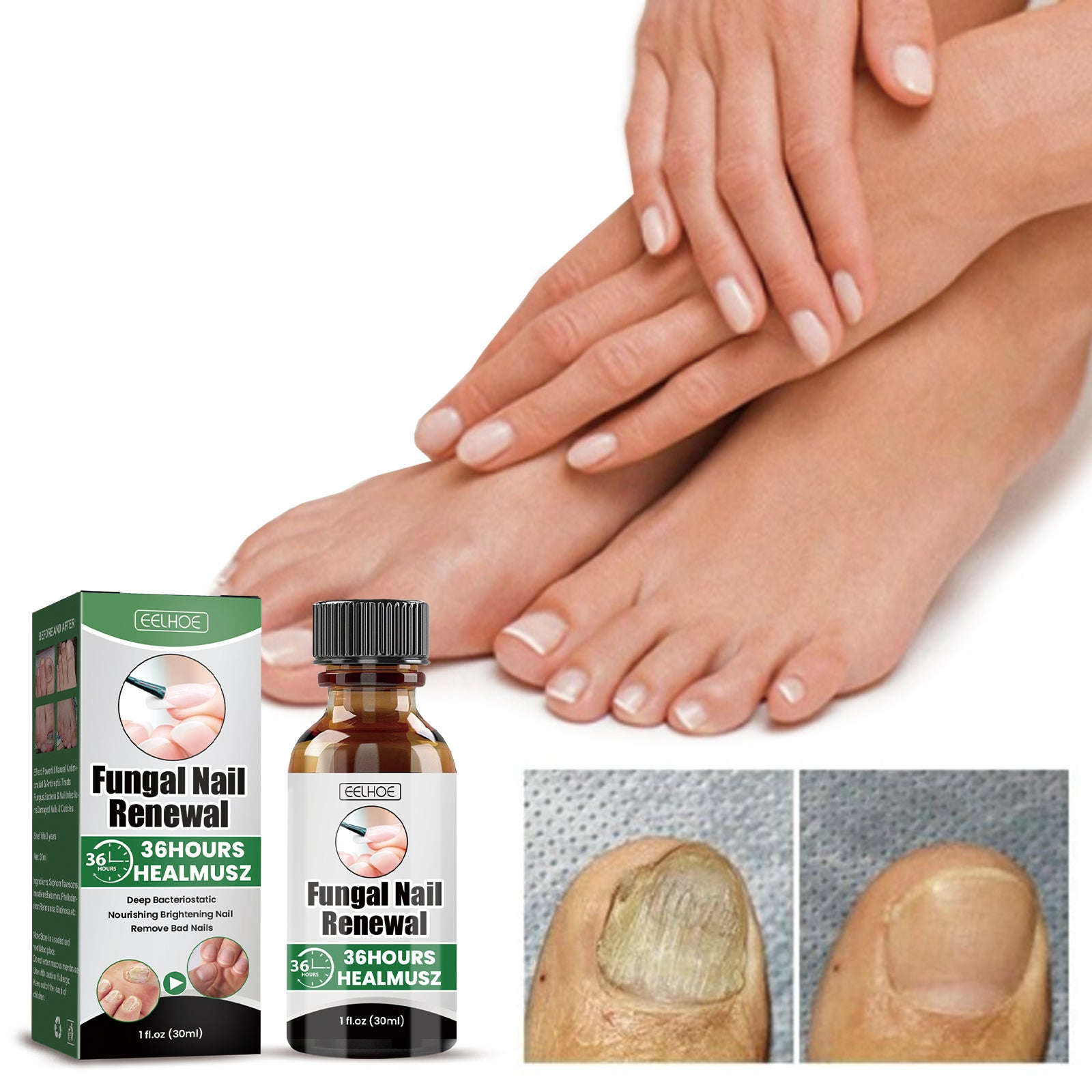 Nail Repair Lotion – Brightening, Nourishing & Moisturizing Nail Care - Icon Her