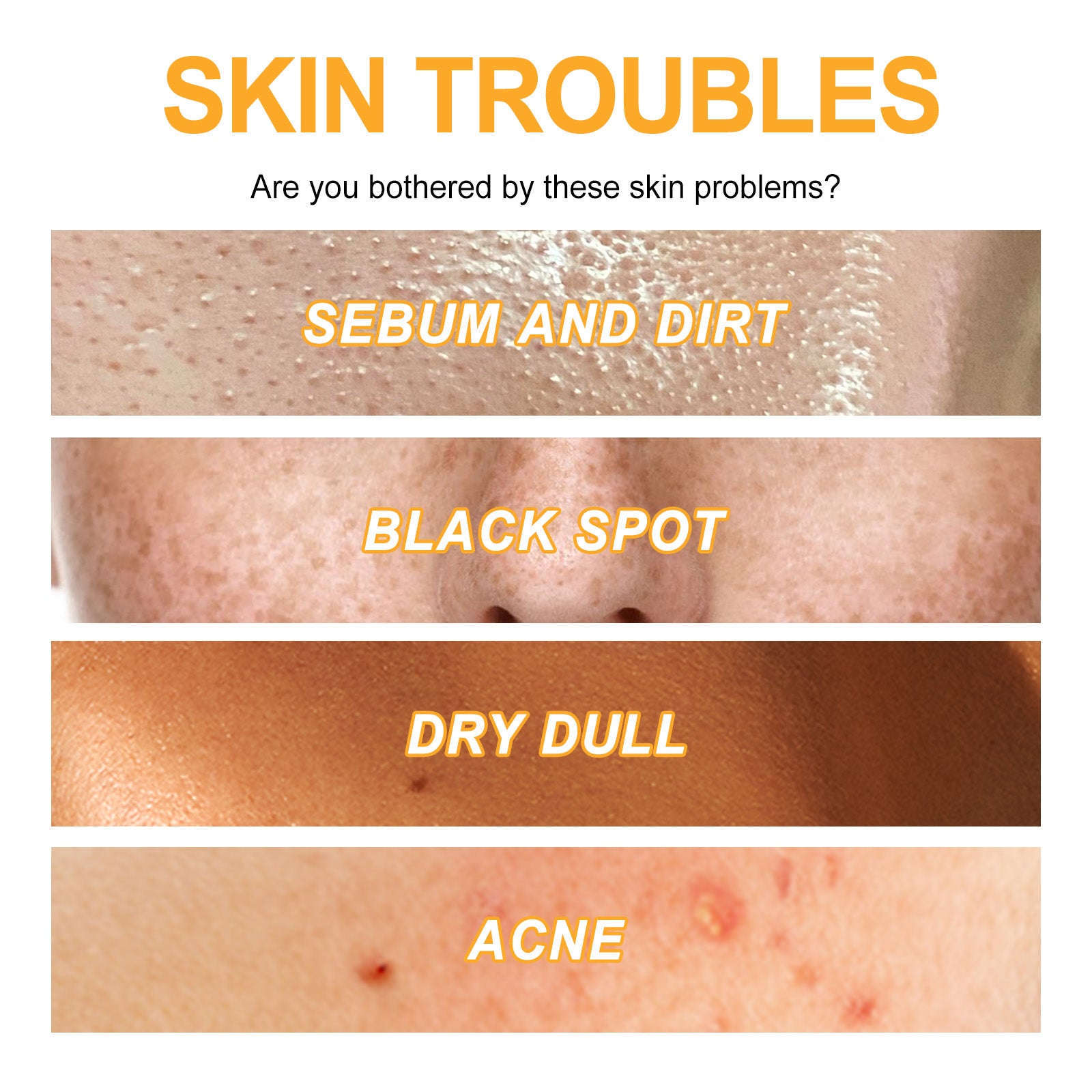 Orange Exfoliating Gel – Deep Cleansing, Anti-Acne, Pore Shrinking & Brightening - Icon Her