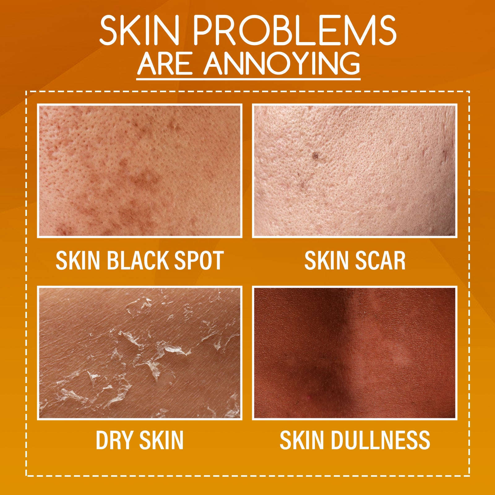 Orange Peeling Body Lotion – Exfoliating, Brightening & Moisturizing Skin - Icon Her