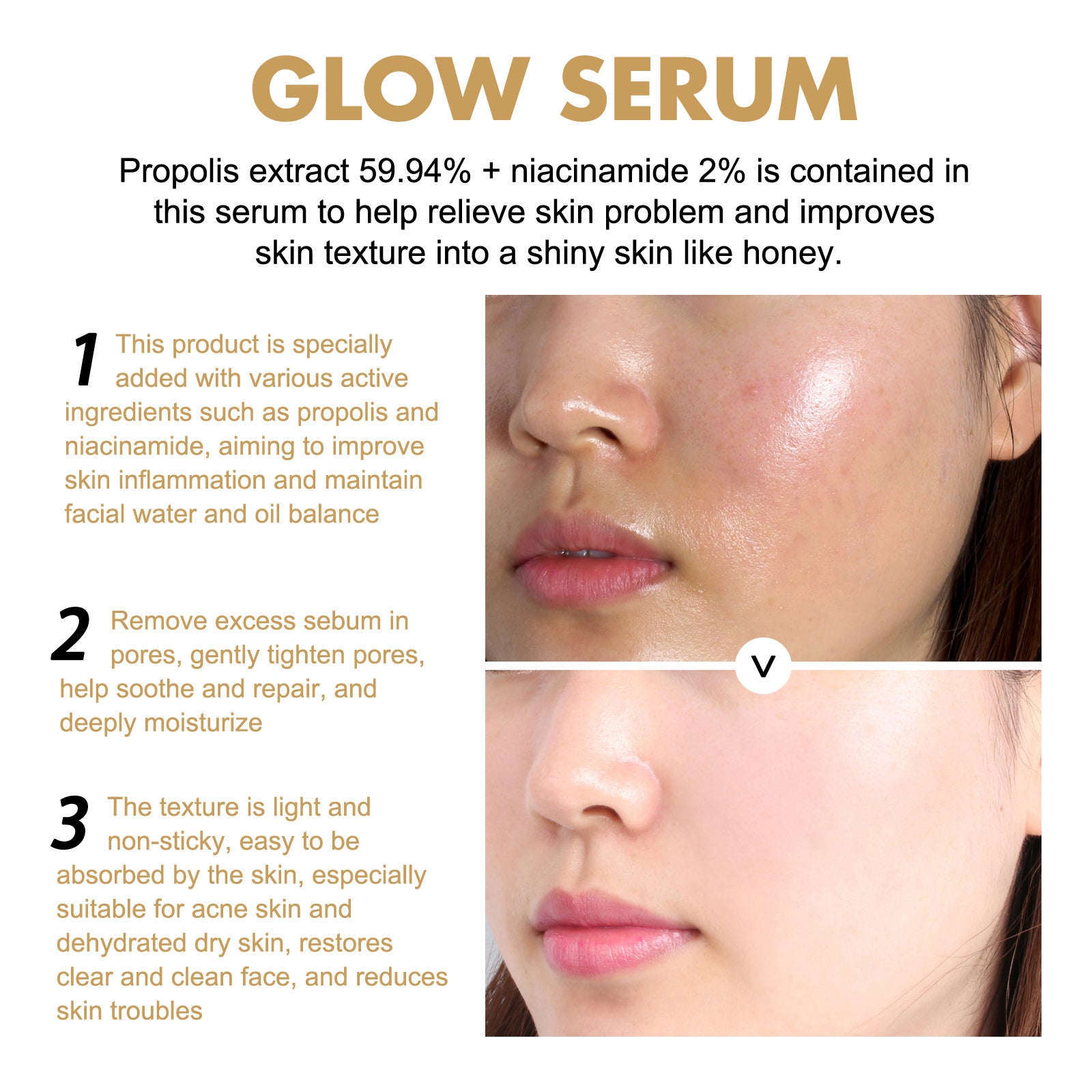 Propolis & Niacinamide Glow Serum - Dark Spot Fading & Radiance Serum - Icon Her